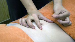 Acupuncture is one type of alternative health treatments.